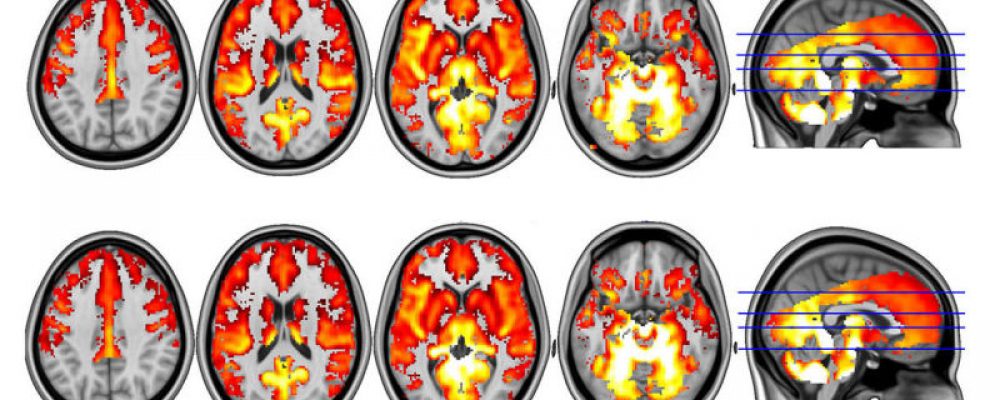 Descubren que las setas alucinógenas son capaces de reiniciar el cerebro de personas con depresión severa